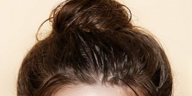 Ingrown hair
